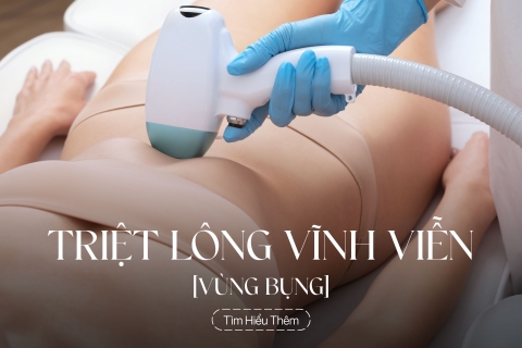 Triệt lông vùng bụng vĩnh viễn